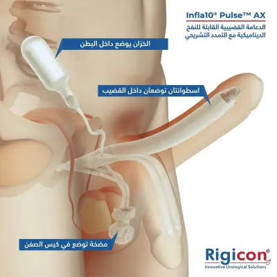 رسم توضيحي لمنتج الدعامة القضيبية الديناميكية القابلة للنفخ Infla10 Pulse AX